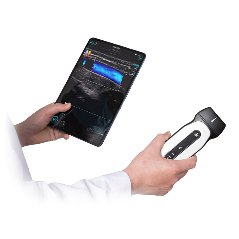 SonoEye P2