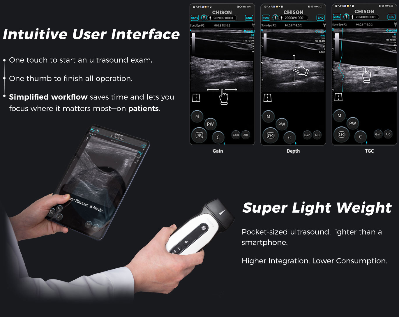 SonoEye P2 VET