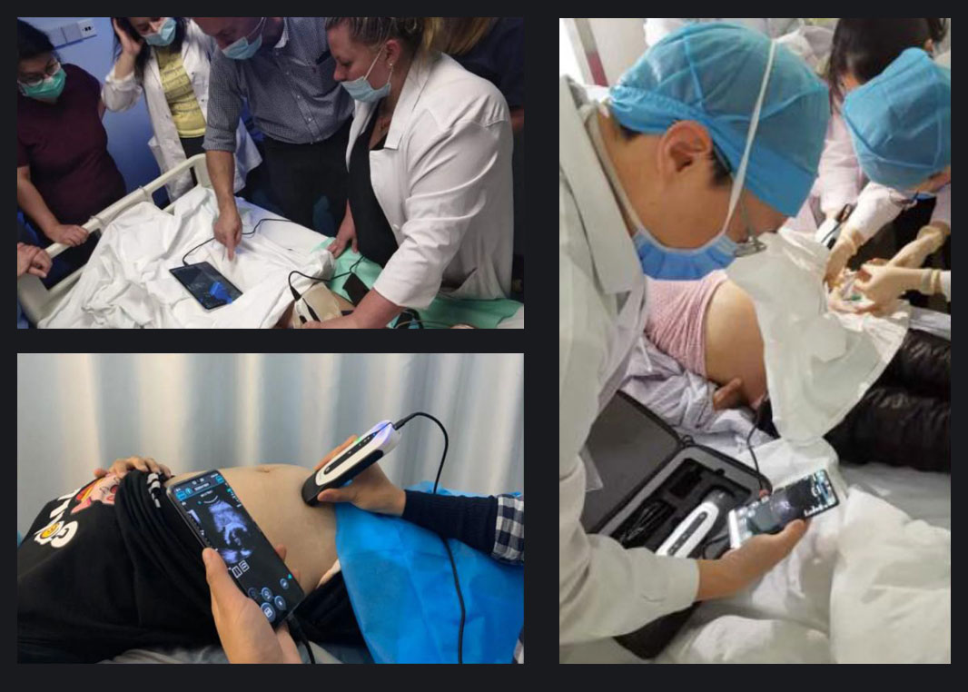 CHISON SonoEye 的愿景是增强女性健康。