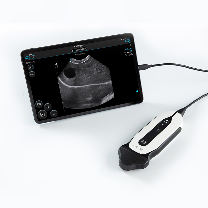 SonoEye P6 知道