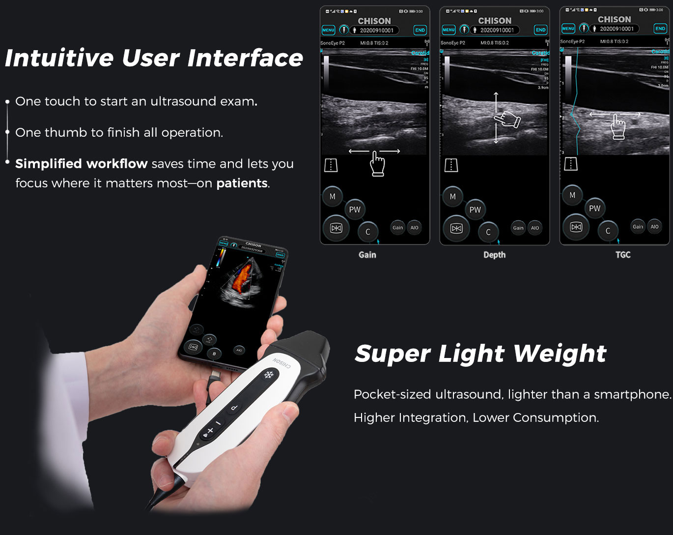SonoEye P3 VET