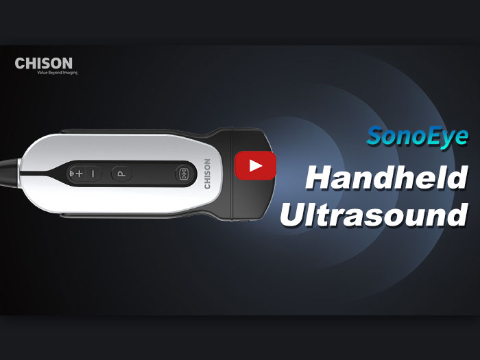 handheld portable ultrasound system