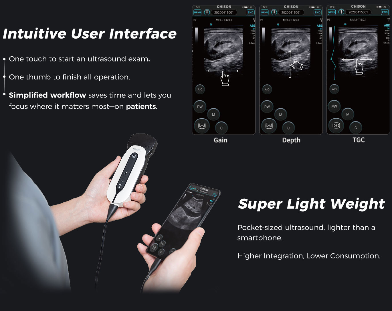 SonoEye P5 VET