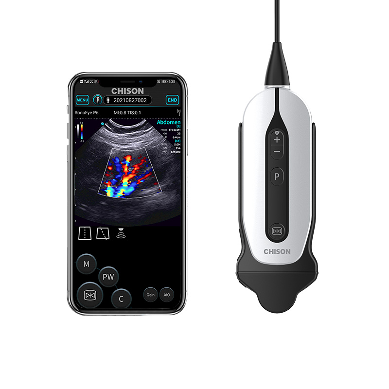 SonoEye P6
