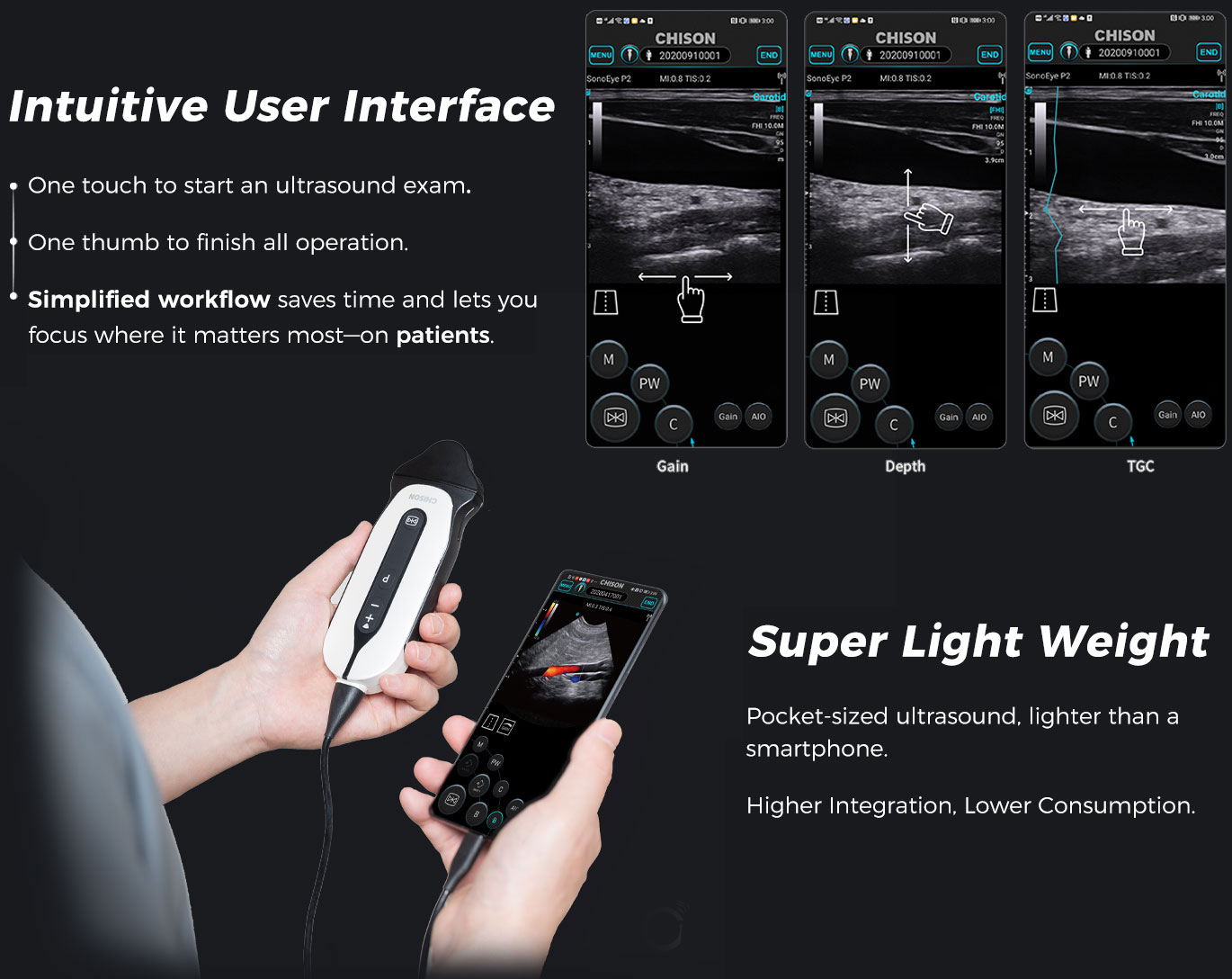 SonoEye P6 VET