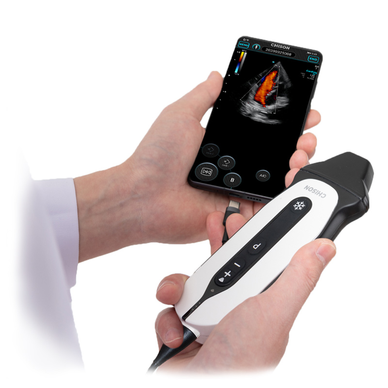 SonoEye P3 VET