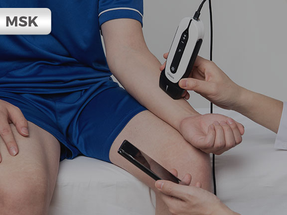SonoEye in MSK