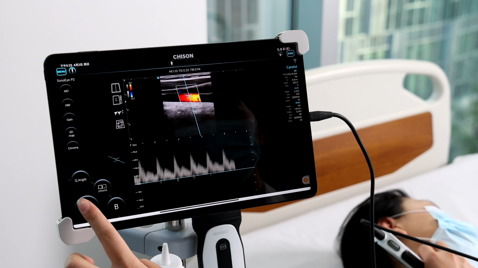 The Point-of-Care Ultrasound (POCUS) Revolution