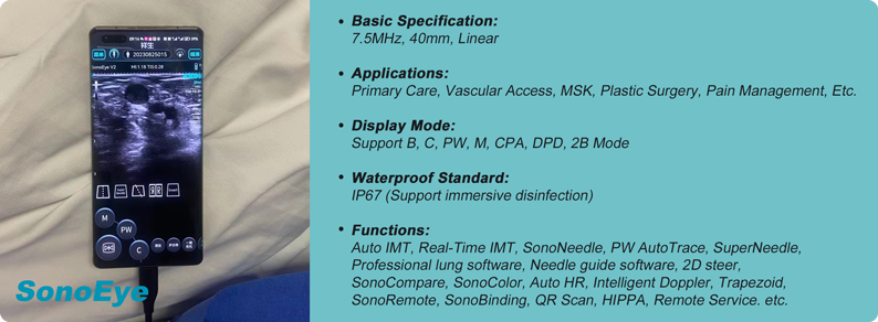 Enhancing Clinical Efficiency and Patient Safety with Handheld Ultrasound and Mini-Midline Catheters